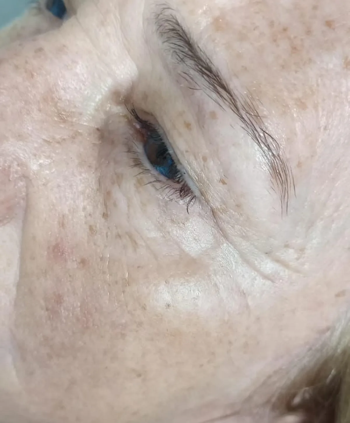 Cosmetología facial en Narella